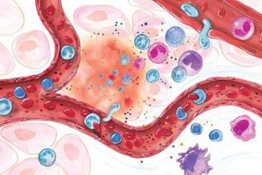 Wpływ Boswellii na obszary ciała objęte stanem zapalnym