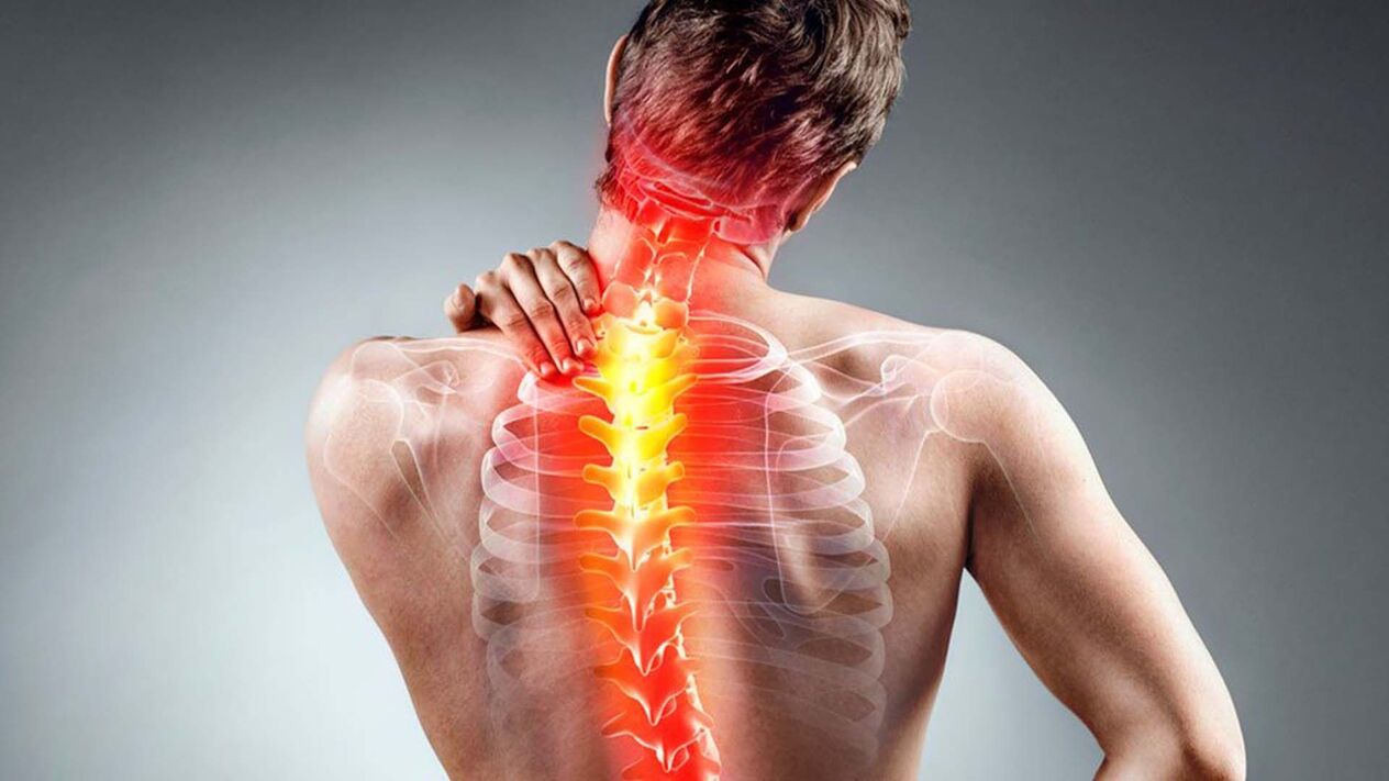 objawy osteochondrozy kręgosłupa